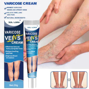 varicose veins cream packaging with application on legs from ghg global powerhouse